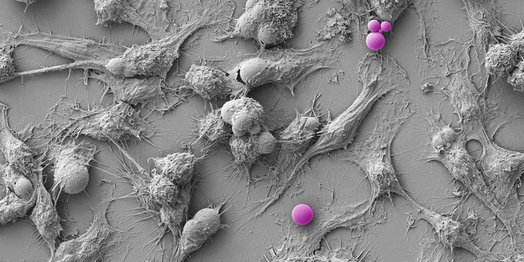 Dr Eleonore Bolle's 2020 Science in Focus competition entry