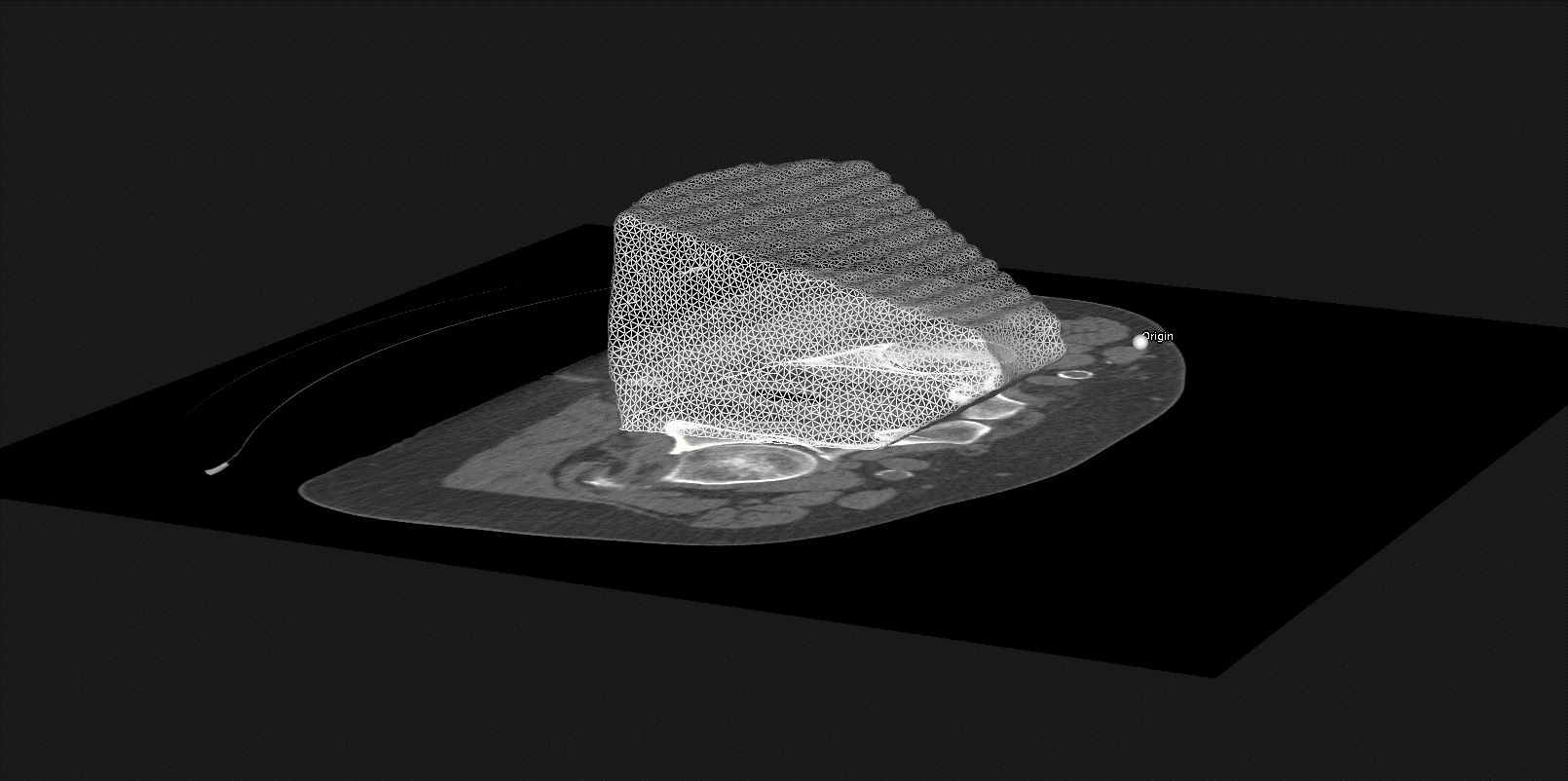 Ultrasound based guidance for radiotherapy Medical Physics