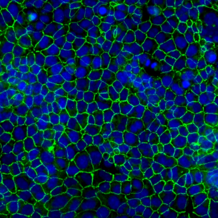 A photo of corneal endothelial cells stained to show their borders in green and nuclei in blue.