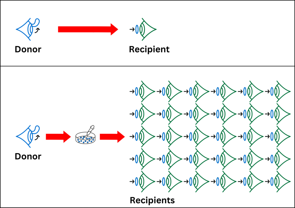 Diagram showing one donor eye and one recipient eye, then one donor, a dish with cells growing in the lab, and 30 recipient eyes.