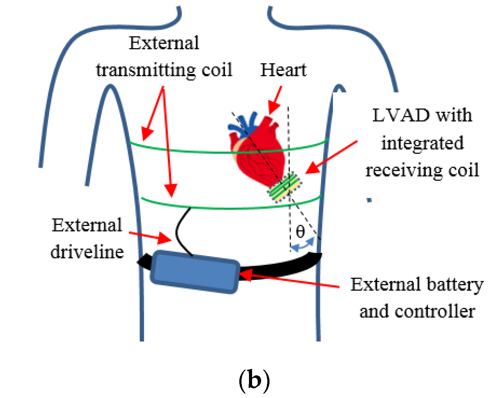 DrivelineFree Energy System for Ventricular Assist Devices Power