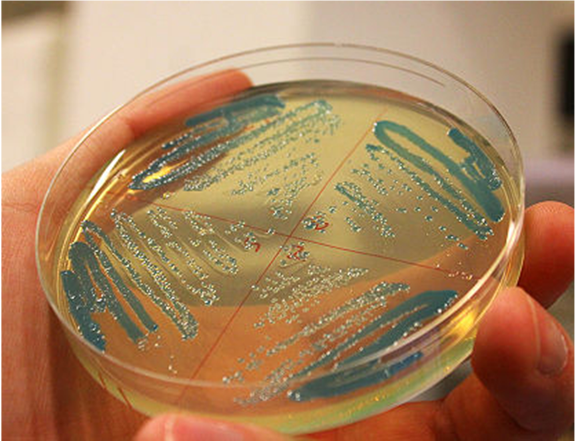 a hand holding an agar plate with blue growth